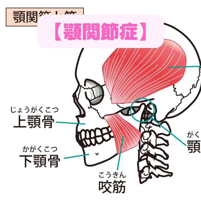 画像1451