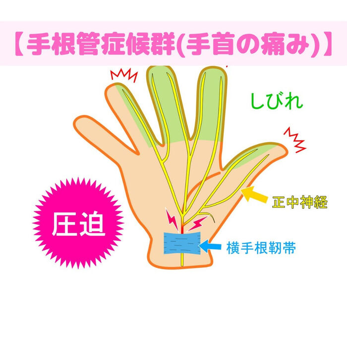 画像1503