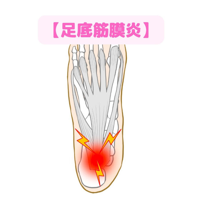 画像1524