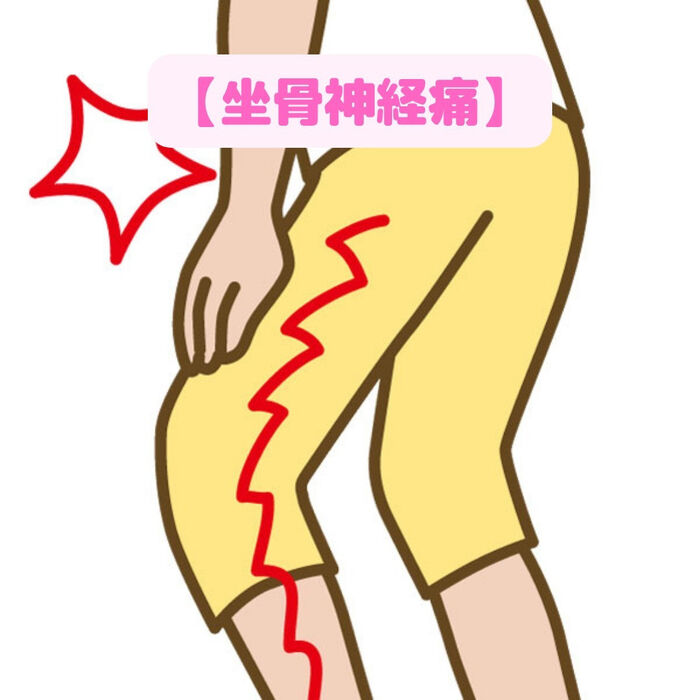 画像1734